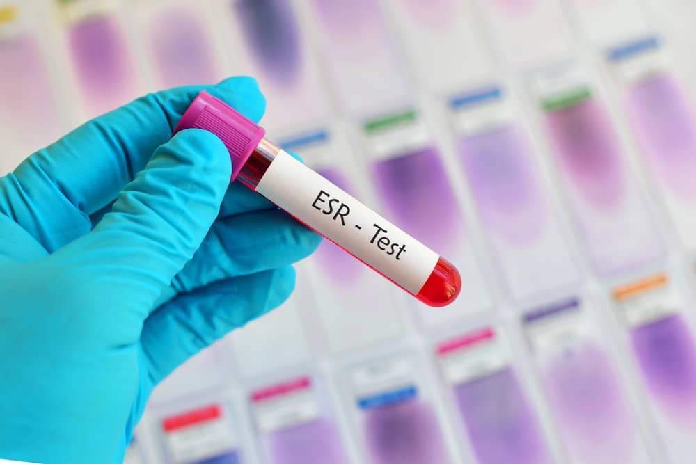 ESR-Test-In-Hindi